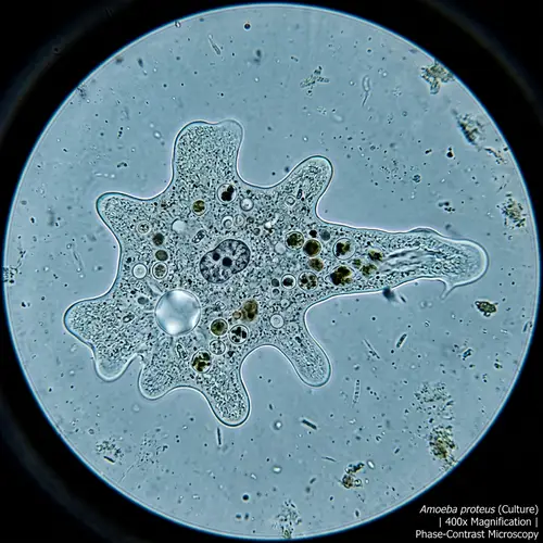 Amoeba Proteus Under Microscope - 400x Magnification