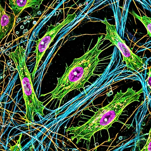 Microscopic Insights into Fibroblasts' Structure