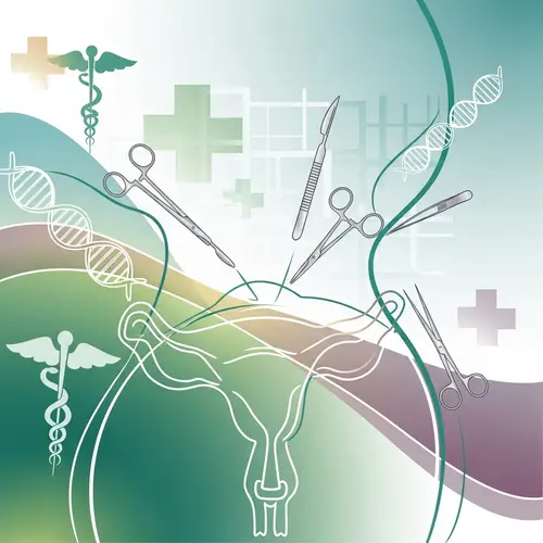 Abstract Hysterectomy Art | Symbolic Medical Procedure