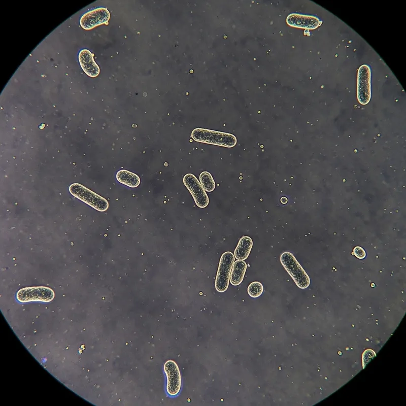 Understanding Bordetella Pertussis: Whooping Cough Agent