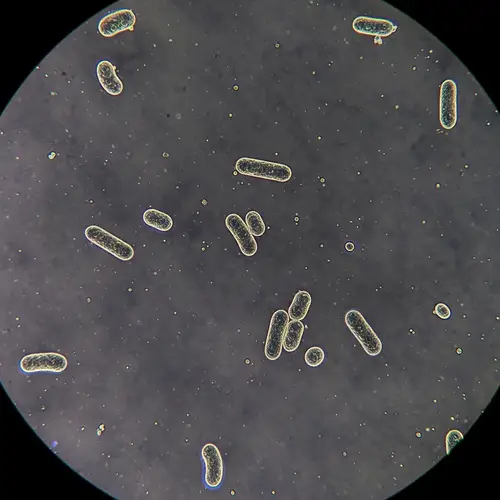 Understanding Bordetella Pertussis: Whooping Cough Agent