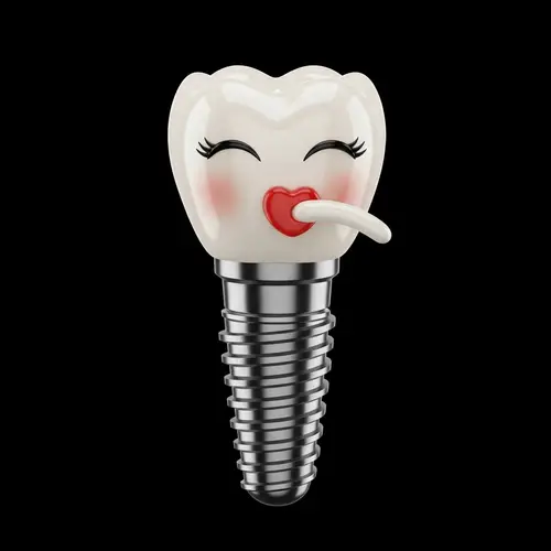 Artistic Dental Implant Emanating Charm | Unique Artwork