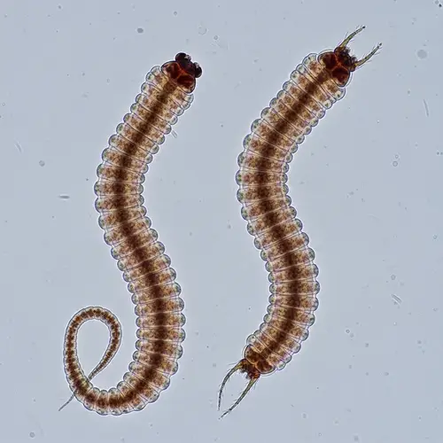 Microscopic View of Male and Female Ascaris Lumbricoides