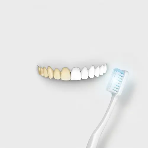 Minimalist Teeth Whitening: Achieve a Bright Smile