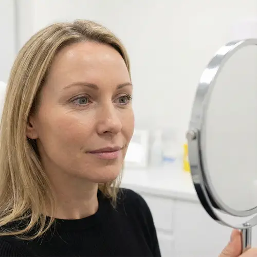 What Would I Look Like with Botox?