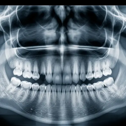 Detailed Oral Dental X-Ray Imaging