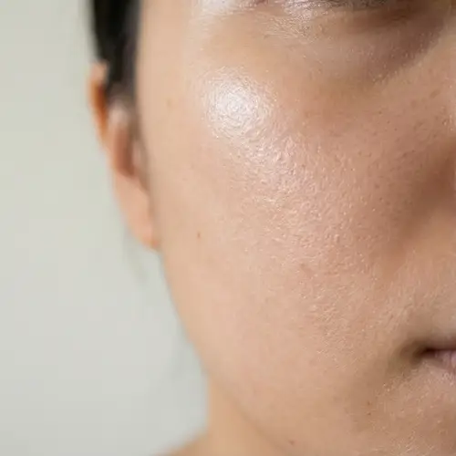 Natural Healthy Skin | Glowing Skin Close-Up