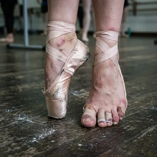 Ballet Dancer Feet: Signs of Dedication and Strain