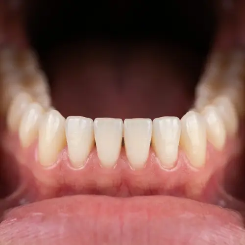Transform Your Smile: Change into Normal Teeth