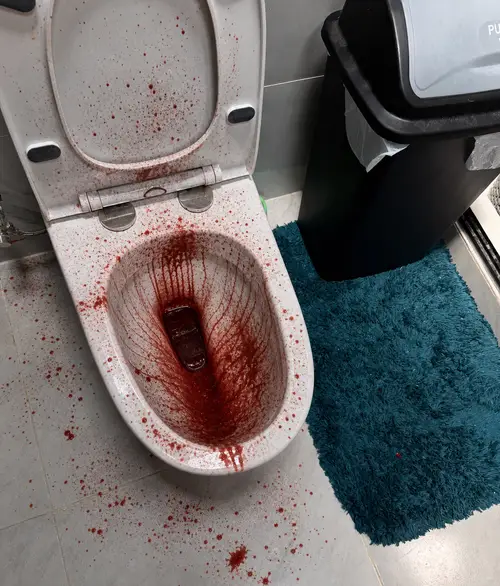 Blood Stains in Toilet: Causes and Solutions