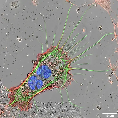 Macrophage with Filopodia: A Cellular Insight