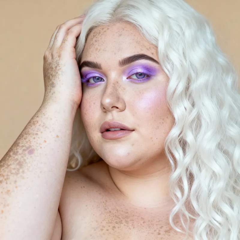 Celebrate Curvy Beauty: Vitiligo and Lavender Eyes