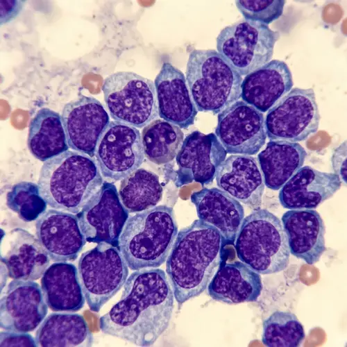 Canine and Feline Lymphoma Cells Under Microscope