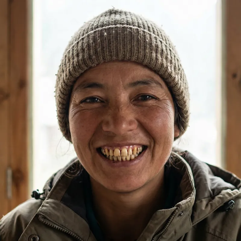 Confident Smile: Embracing Uniqueness & Beauty