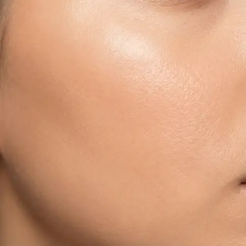 Glowing Clean Skin | Healthy Complexion Photo