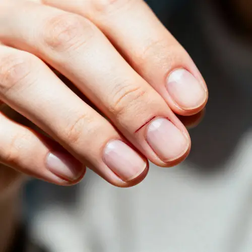 Close-Up of a Minor Cut on a Human Hand
