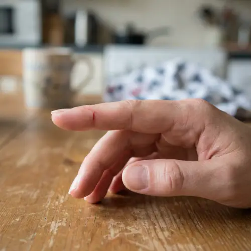 Close-Up of a Minor Cut on a Human Hand