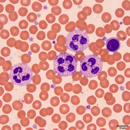 Neutrophils: White Blood Cells Under the Microscope