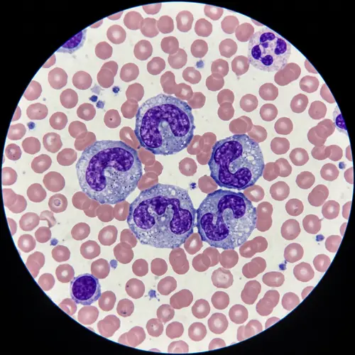 Monocytes Under the Microscope: A Realistic View