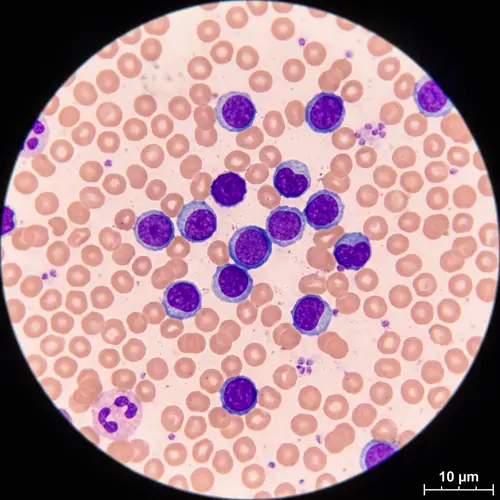 Lymphocytes Under a Microscope: Detailed Visualization