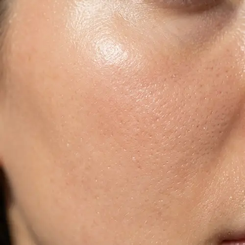 Radiant Skin Texture | Healthy Glow Close-Up