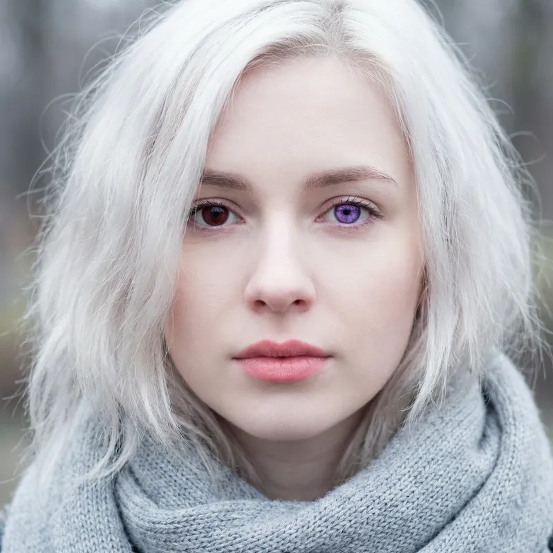 Pale Caucasian Girl with White Hair and Mismatched Eyes - Unique Beauty