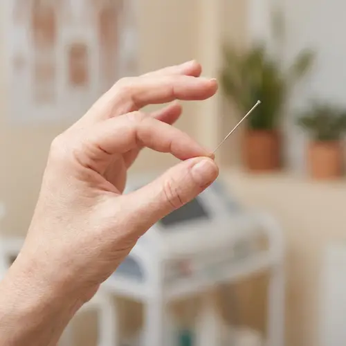 Detailed Caucasian Woman's Hand with Acupuncture Needle