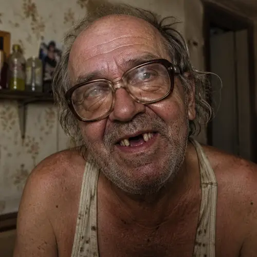 Old Man with Thick Glasses and Missing Teeth