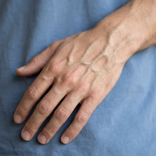 Visible Veins in My Hand: Causes and Tips