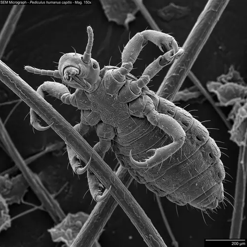 Detailed Photomicrograph of Lice - Scientific Monochrome Study